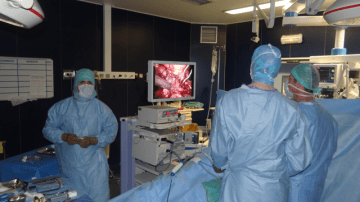 Chirurgie coelioscopique