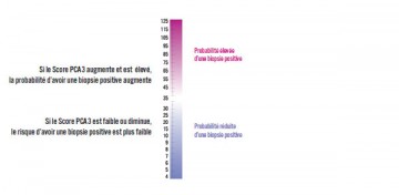 interpretation_PCA3_cancer_prostate_PSA