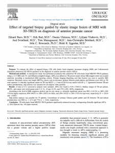 MRI_targeted_biopsy_prostate_cancer