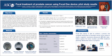 Focal_one_hifu_prostate_cancer