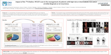 PET_choline_prostate_cancer_high_risk