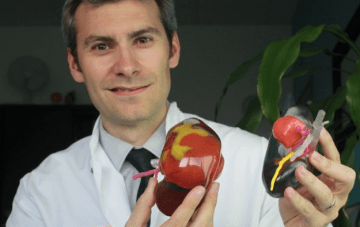 impression_3D_soud_ouest_bordaux_urologie