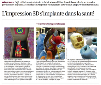 impression_3D_santé_cancer_rein_