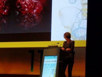 guillaume_adeline_afu_2016_urologie