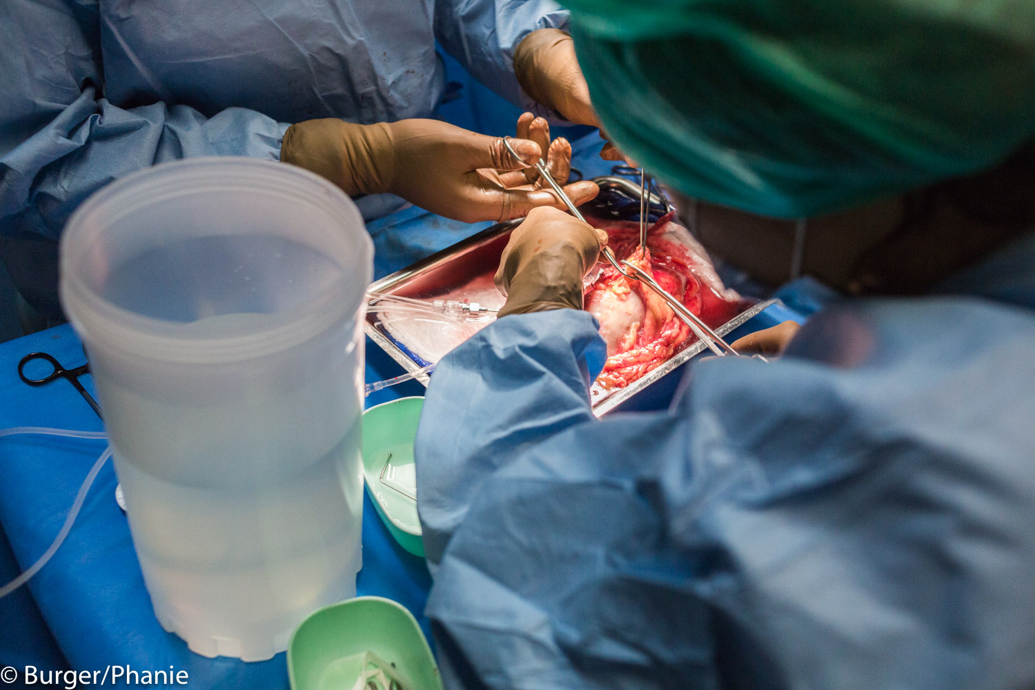 Équipe chirurgicale du CHU de Bordeaux au cours d’une transplantation rénale