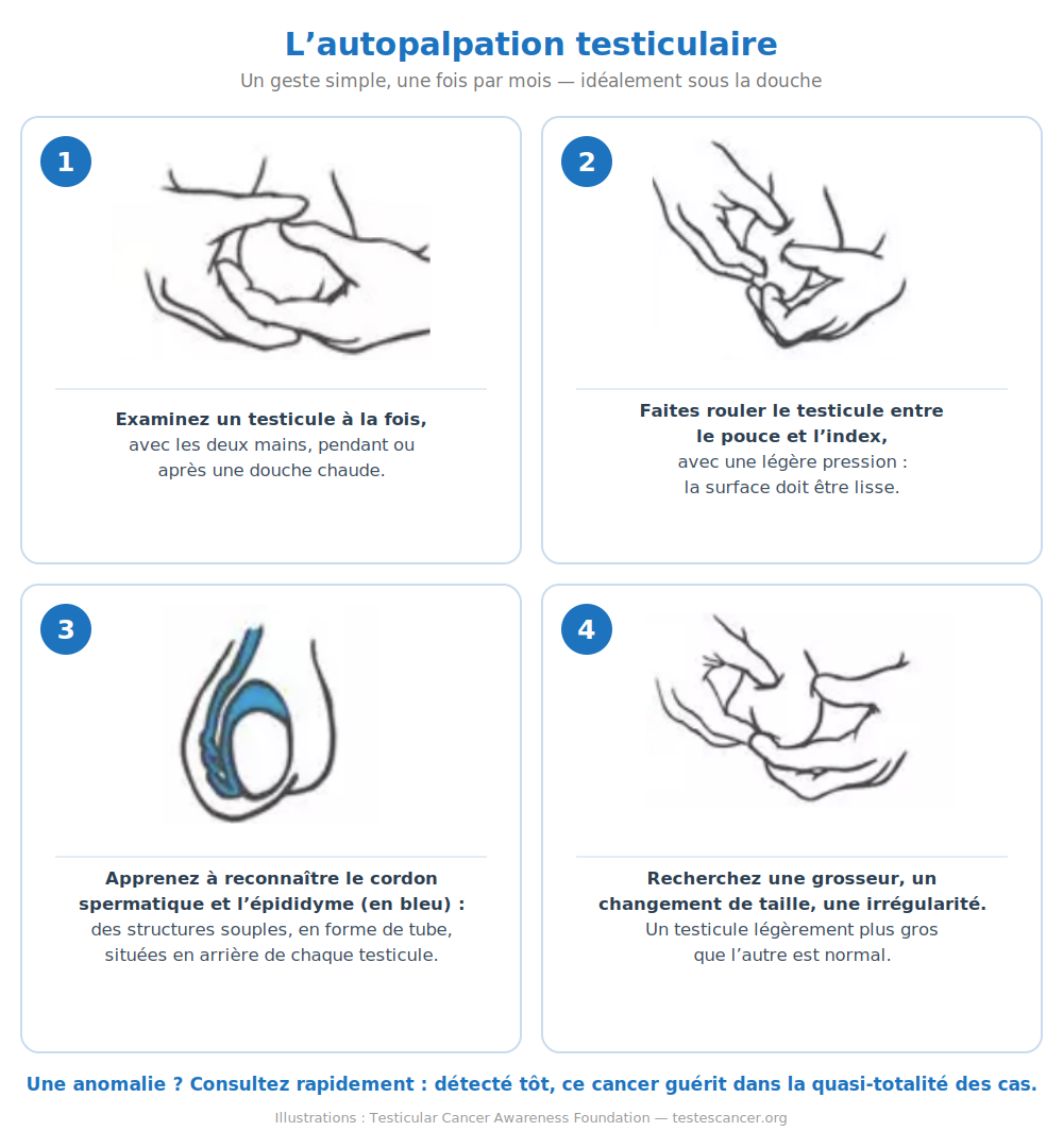 L’autopalpation testiculaire en 4 étapes illustrées